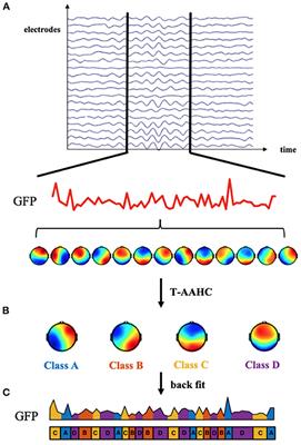 Altered Microstate Dynamics and Spatial Complexity in Late-Life Schizophrenia